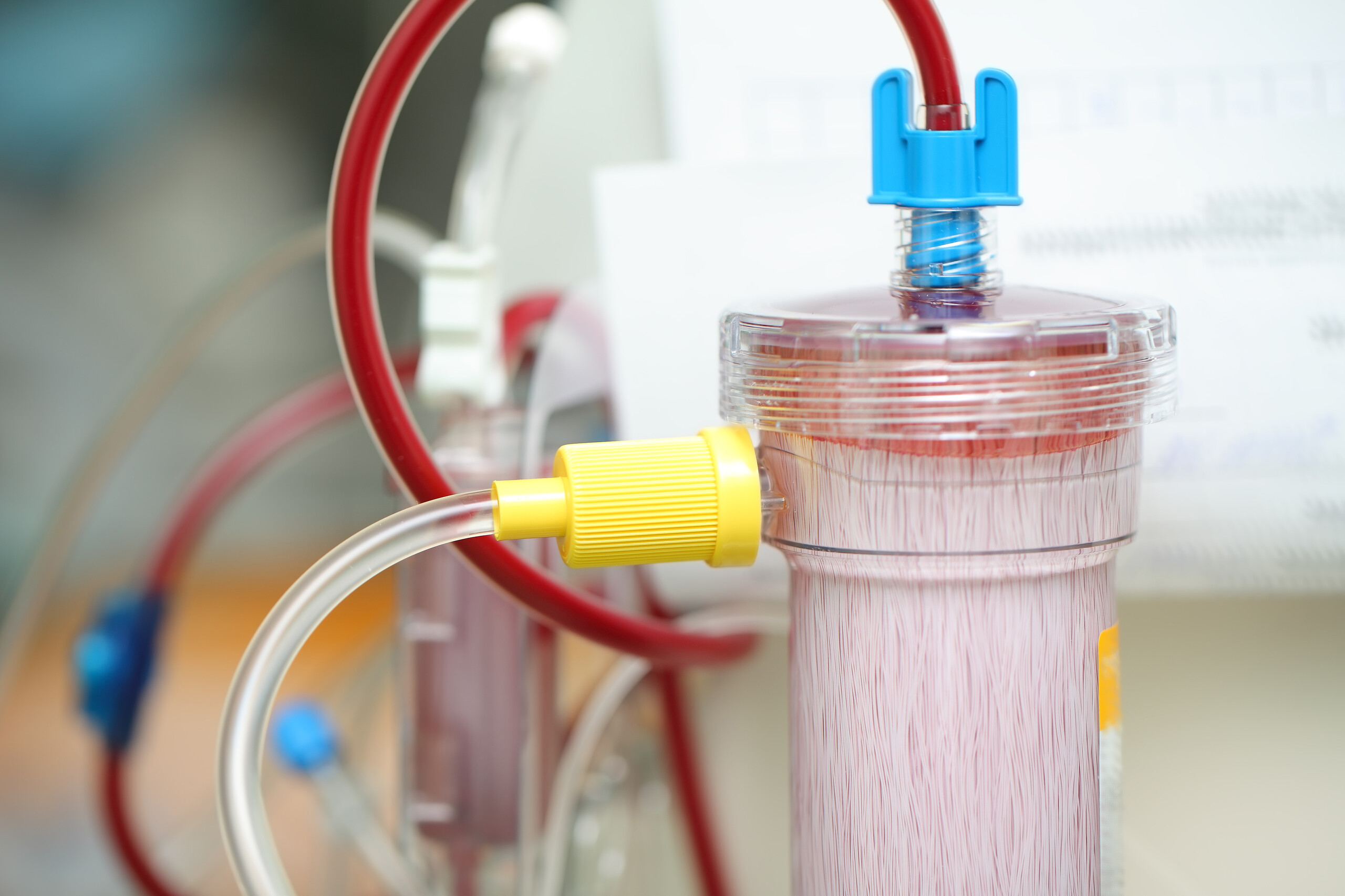 dialysis_equipment_during_blood_filtration